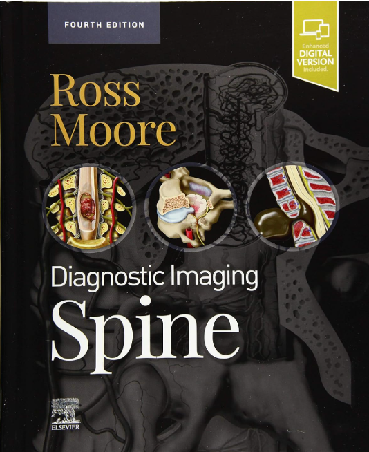 Diagnostic Imaging: Spine